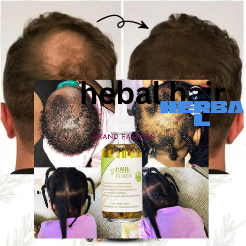 HEBAL HAIR GROTH OIL
